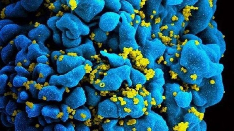 دواء لعلاج «الإيدز» ينجح في أول اختباراته السريرية
